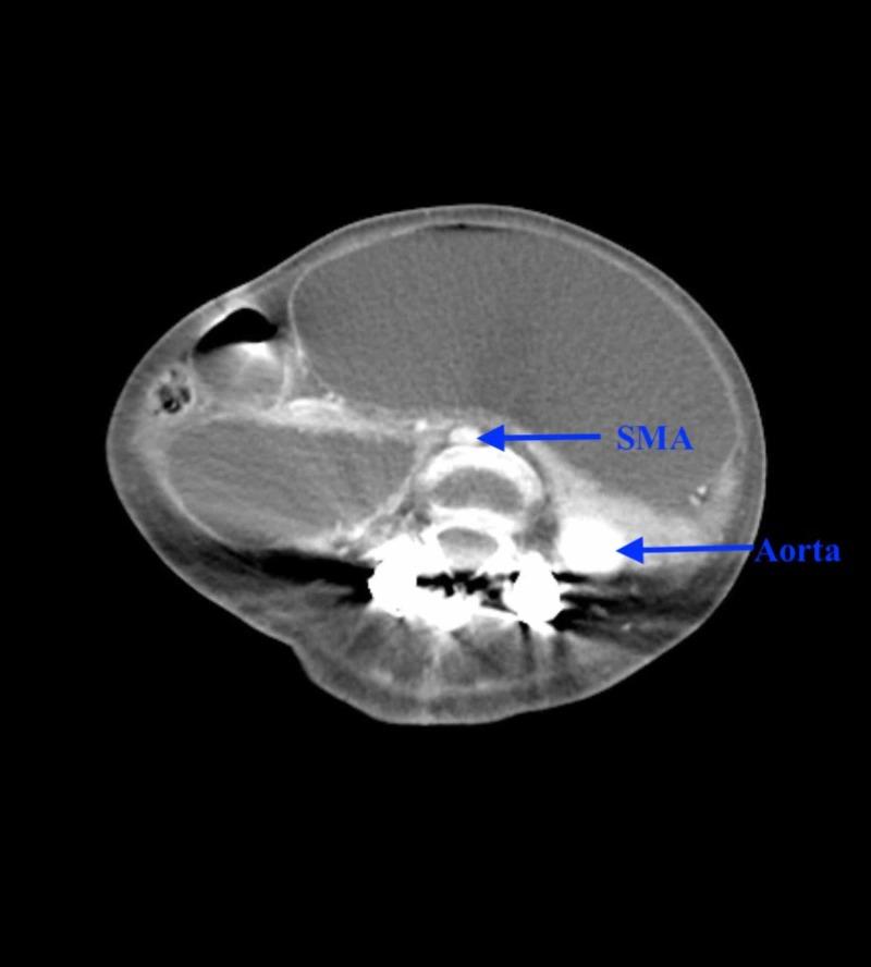 https://cdn.ncbi.nlm.nih.gov/pmc/blobs/6e98/6609291/75203f28777c/cureus-0011-00000004609-i03.jpg