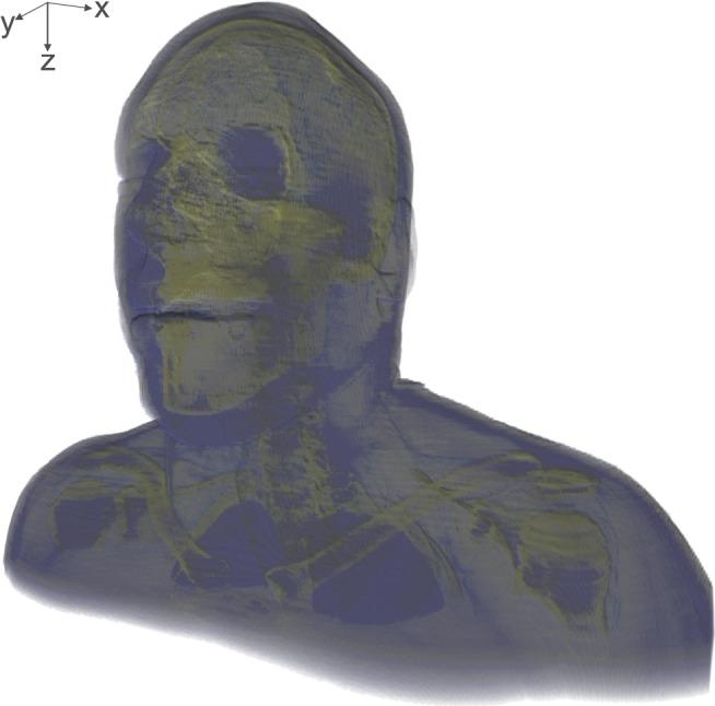 https://cdn.ncbi.nlm.nih.gov/pmc/blobs/6e99/4234661/2ce261cd322b/pone.0113339.g002.jpg