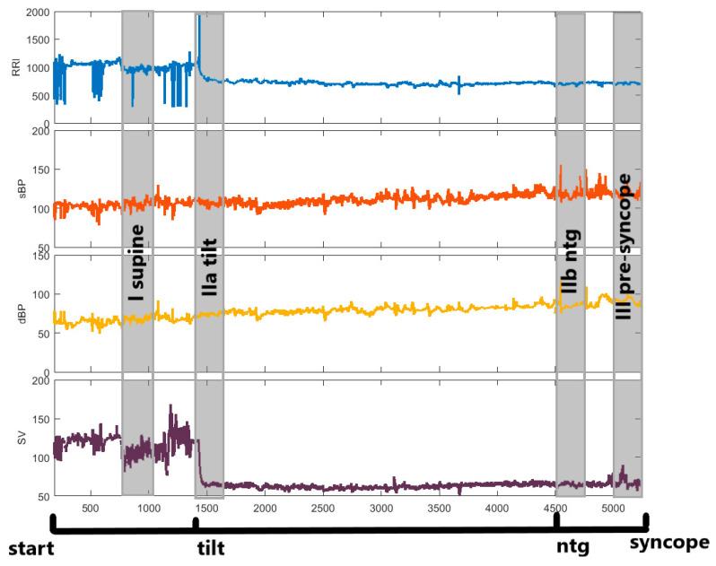https://cdn.ncbi.nlm.nih.gov/pmc/blobs/6e99/7512576/eb679d7be4d7/entropy-20-00976-g001.jpg