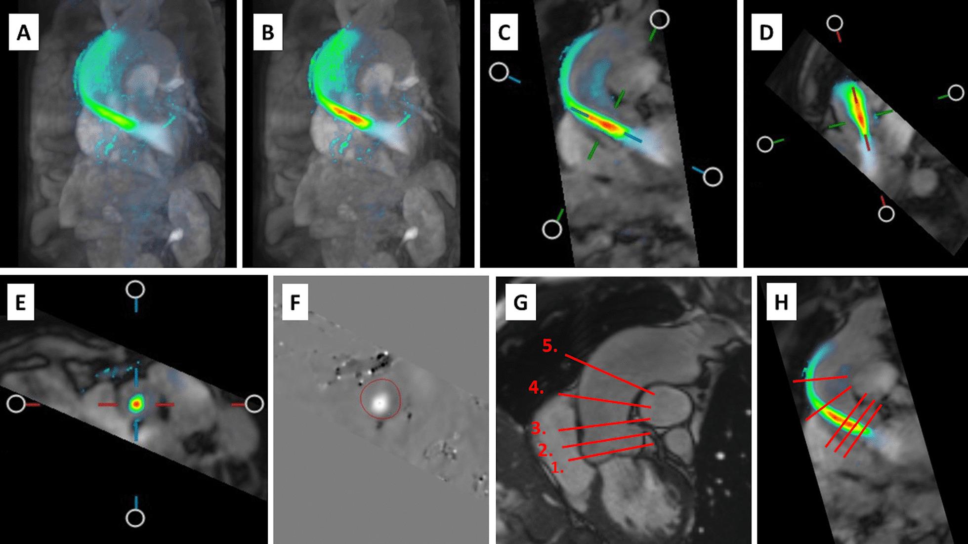 https://cdn.ncbi.nlm.nih.gov/pmc/blobs/6ea6/8591846/b6b5e84c76e8/12968_2021_825_Fig2_HTML.jpg