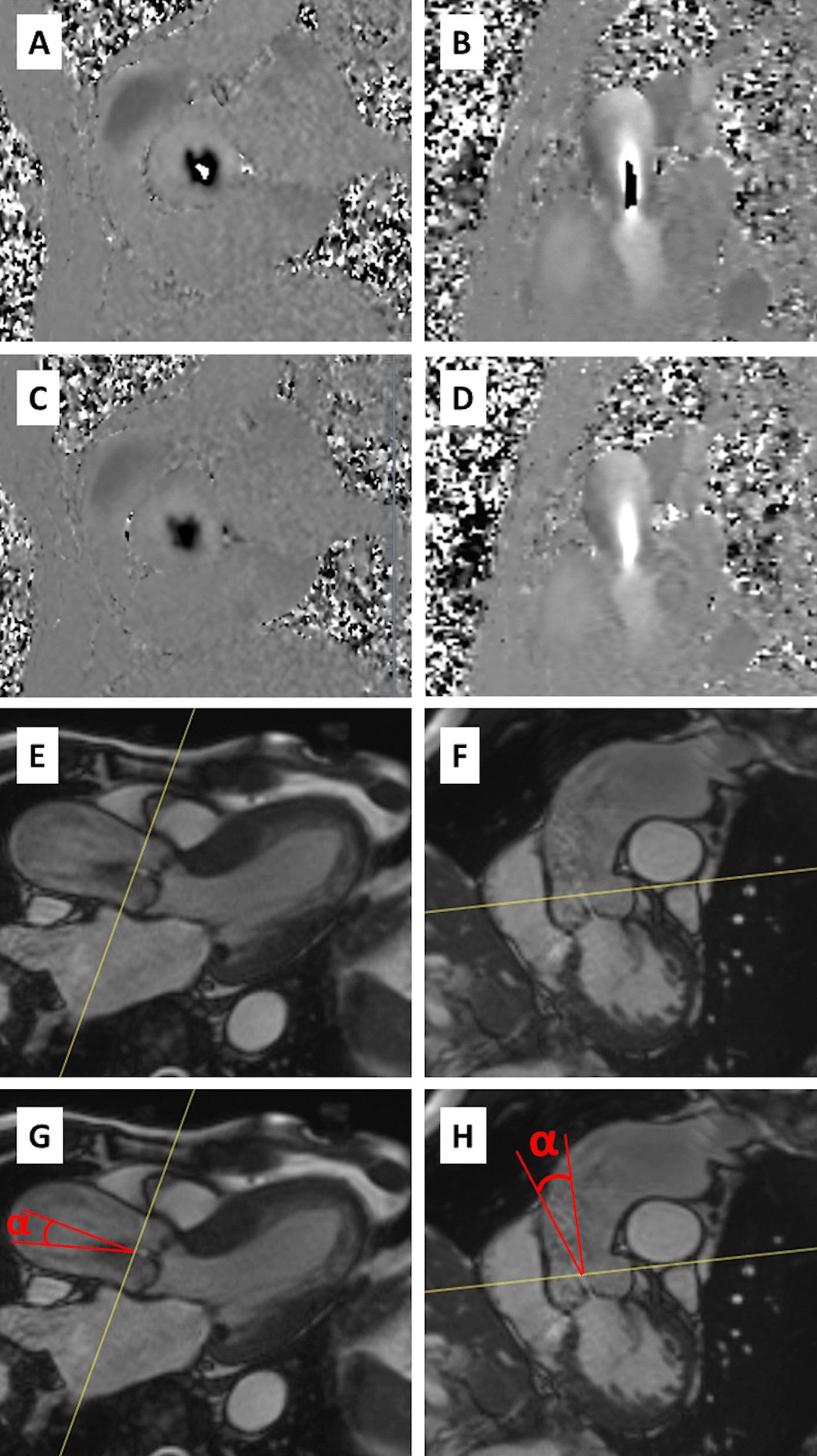 https://cdn.ncbi.nlm.nih.gov/pmc/blobs/6ea6/8591846/cddc9408a3cb/12968_2021_825_Fig1_HTML.jpg