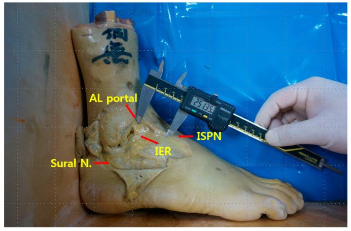 https://cdn.ncbi.nlm.nih.gov/pmc/blobs/6ead/10304507/930a3e4502f6/medicina-59-01109-g001.jpg