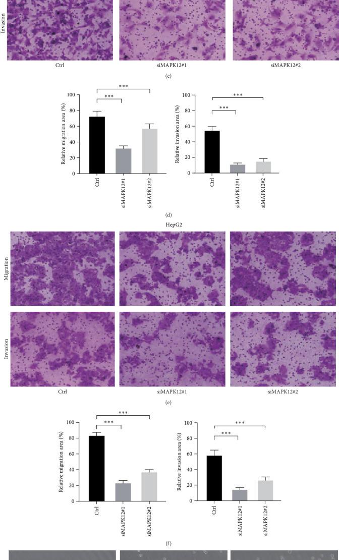 https://cdn.ncbi.nlm.nih.gov/pmc/blobs/6ead/12408136/8064f75b4957/SCI2025-9071464.007.jpg