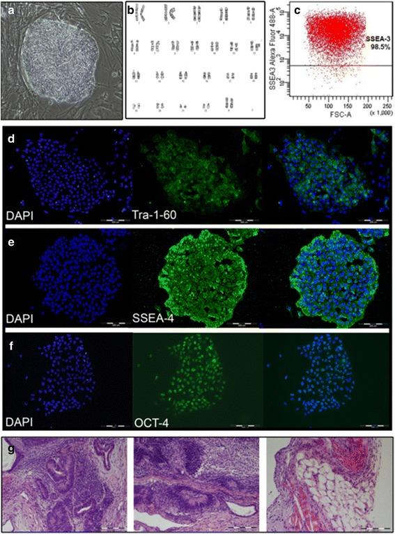 https://cdn.ncbi.nlm.nih.gov/pmc/blobs/6ebb/5180406/c70b6ae5fcf1/12885_2016_2809_Fig3_HTML.jpg