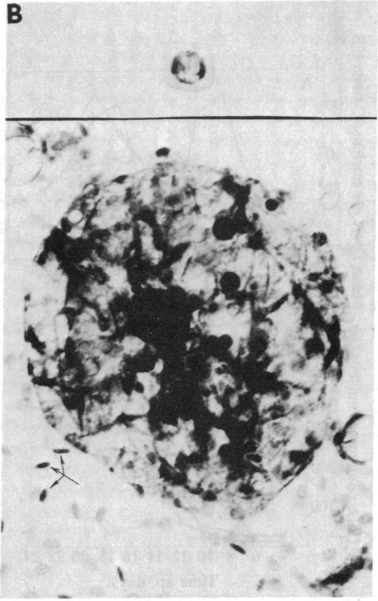 https://cdn.ncbi.nlm.nih.gov/pmc/blobs/6ebc/391299/e8c8ec6500c6/pnas00360-0297-b.jpg