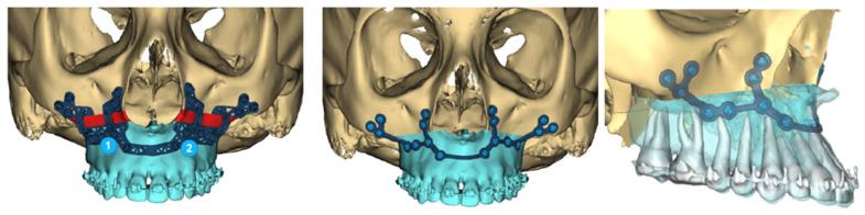 https://cdn.ncbi.nlm.nih.gov/pmc/blobs/6ebe/11995829/179ceca3a587/cmtr-18-00012-g008.jpg