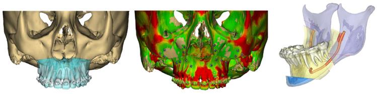 https://cdn.ncbi.nlm.nih.gov/pmc/blobs/6ebe/11995829/59db2218d8d6/cmtr-18-00012-g004.jpg