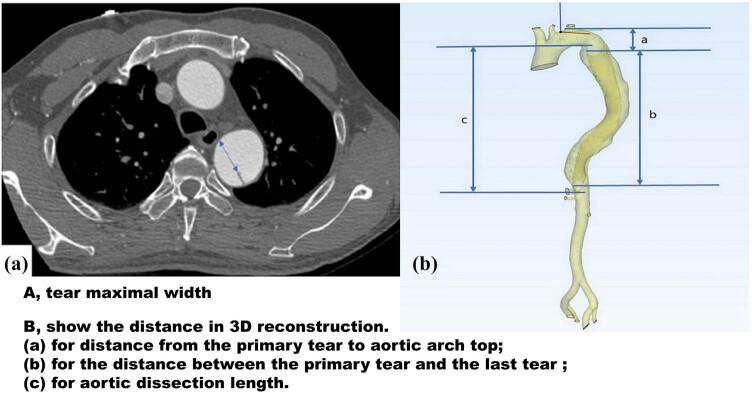 https://cdn.ncbi.nlm.nih.gov/pmc/blobs/6ec1/12086627/09447fdb5c48/j_med-2025-1179-fig001.jpg