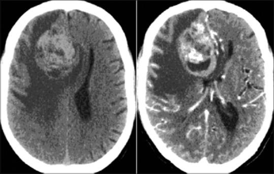 https://cdn.ncbi.nlm.nih.gov/pmc/blobs/6ec7/4352627/0bacf65b4ed1/AJNS-10-39-g001.jpg