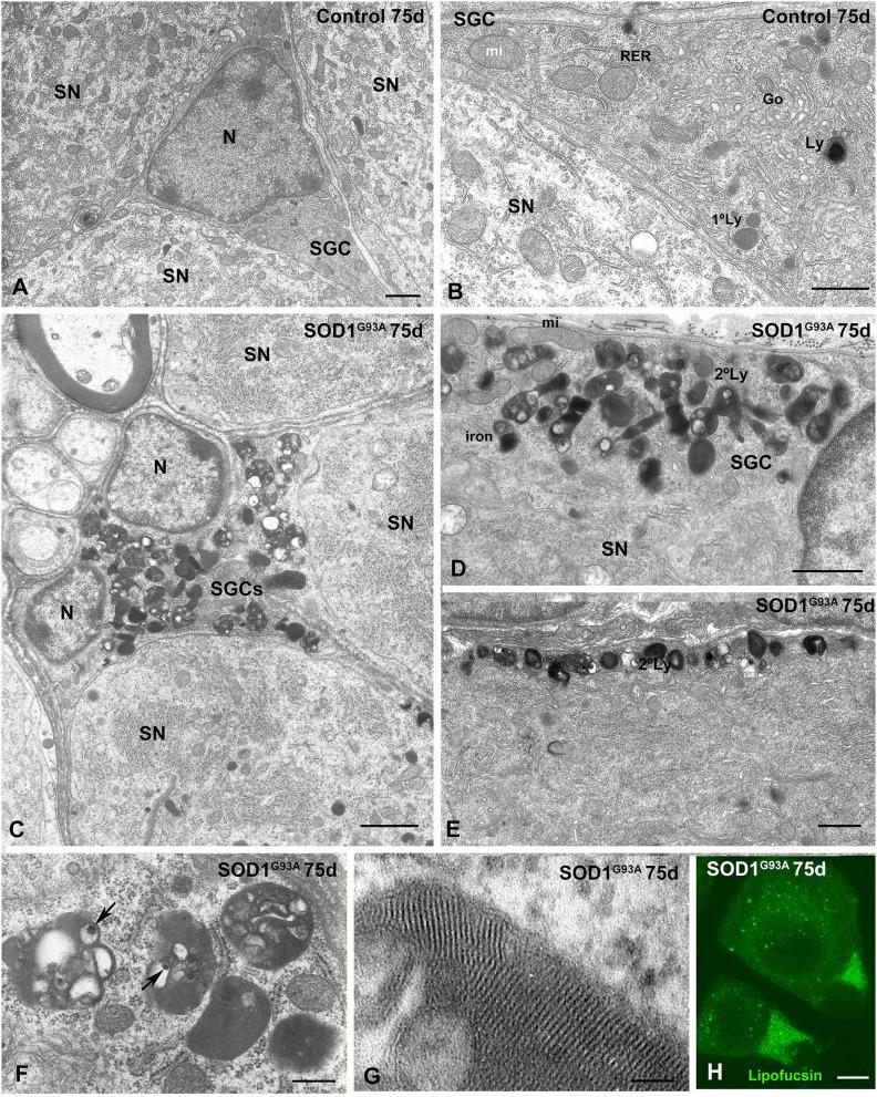 https://cdn.ncbi.nlm.nih.gov/pmc/blobs/6ec7/7680735/05a14b713c1c/fnagi-12-595751-g0005.jpg