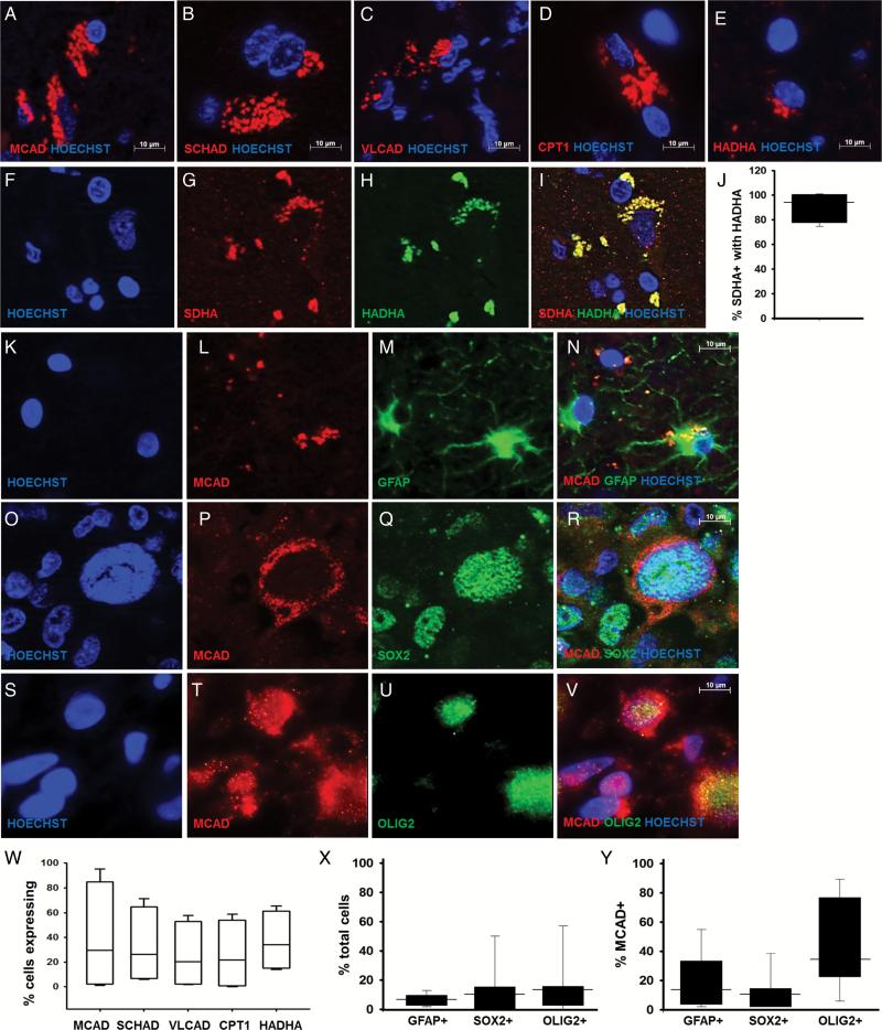 https://cdn.ncbi.nlm.nih.gov/pmc/blobs/6ec8/5193020/8061c87a02d0/neuonc_now128_f0001.jpg