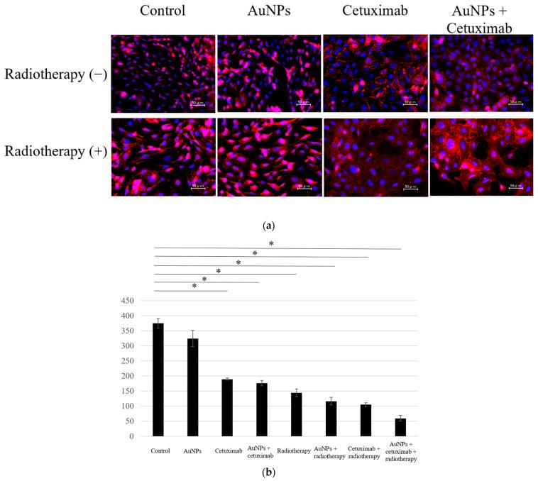 https://cdn.ncbi.nlm.nih.gov/pmc/blobs/6ecb/10705767/335d70af49b6/cancers-15-05697-g001.jpg