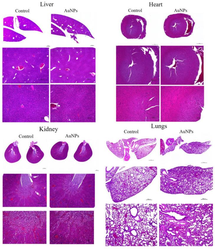 https://cdn.ncbi.nlm.nih.gov/pmc/blobs/6ecb/10705767/a0304c5ee991/cancers-15-05697-g007.jpg