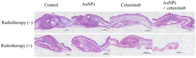 https://cdn.ncbi.nlm.nih.gov/pmc/blobs/6ecb/10705767/abb6c6ce3182/cancers-15-05697-g005.jpg
