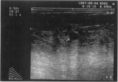 https://cdn.ncbi.nlm.nih.gov/pmc/blobs/6ed7/1191423/cb17fd2e62e7/annsurg00005-0037-a.jpg