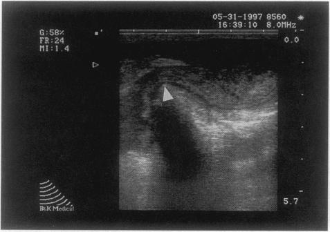 https://cdn.ncbi.nlm.nih.gov/pmc/blobs/6ed7/1191423/e4557fdbf555/annsurg00005-0036-b.jpg