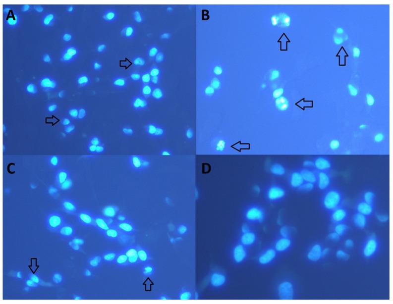 https://cdn.ncbi.nlm.nih.gov/pmc/blobs/6ed8/7277666/f42c9805e504/biomolecules-10-00737-g004.jpg