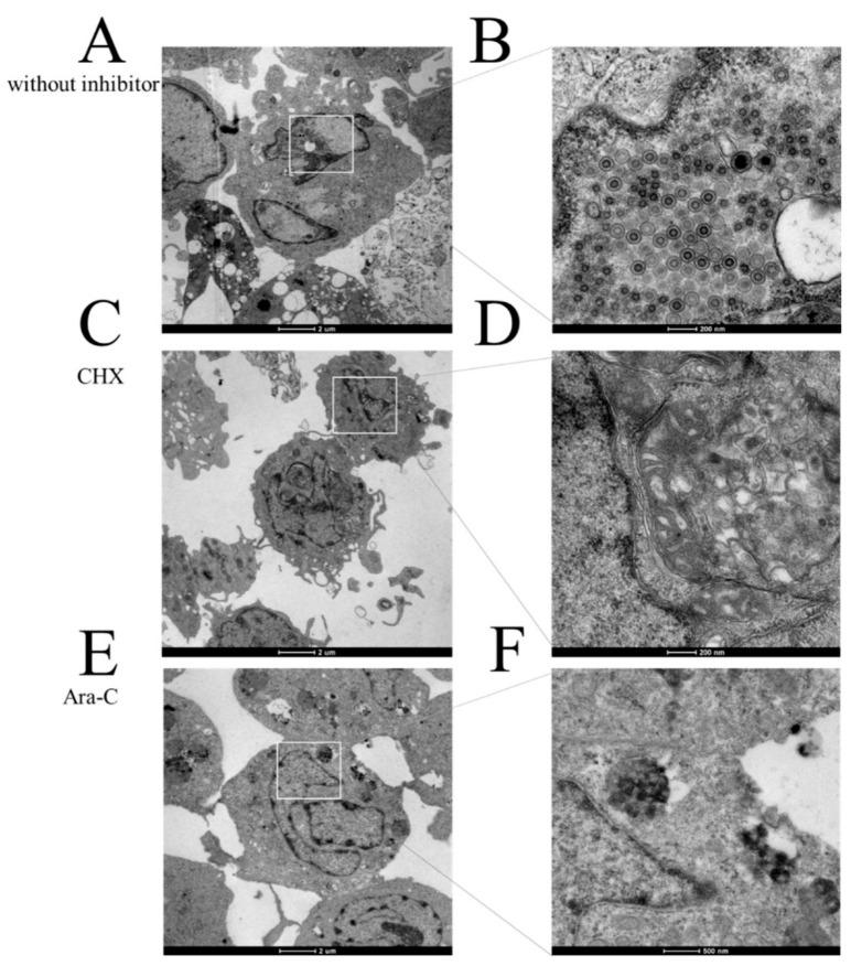 https://cdn.ncbi.nlm.nih.gov/pmc/blobs/6edf/7552009/b6cab1aa24cf/viruses-12-00994-g005.jpg