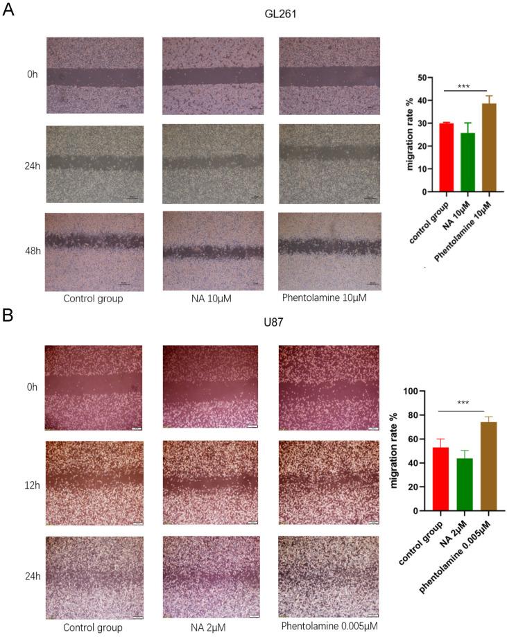 https://cdn.ncbi.nlm.nih.gov/pmc/blobs/6ee2/11414618/1cc4f6cb7748/jcav15p5691g011.jpg