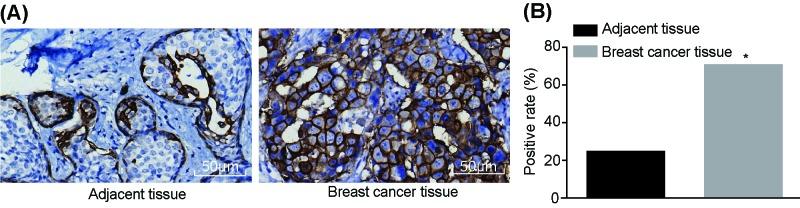 https://cdn.ncbi.nlm.nih.gov/pmc/blobs/6ee6/6146293/1df91b2569a7/bsr-38-bsr20180571-g1.jpg