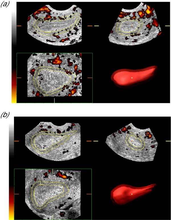 https://cdn.ncbi.nlm.nih.gov/pmc/blobs/6ee8/1208937/5defe182f124/1743-1050-2-10-6.jpg