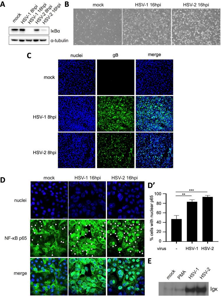 https://cdn.ncbi.nlm.nih.gov/pmc/blobs/6eed/10434116/4d43486ae242/spectrum.01421-23-f003.jpg