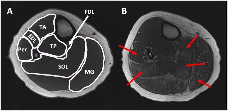 https://cdn.ncbi.nlm.nih.gov/pmc/blobs/6eed/4477876/39adf1698983/pone.0128915.g001.jpg