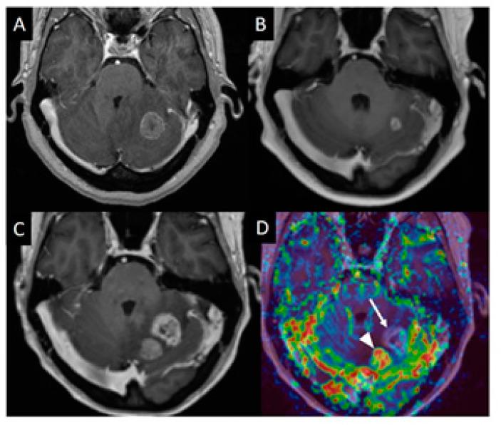 https://cdn.ncbi.nlm.nih.gov/pmc/blobs/6ef8/8197089/c462bba29214/cancers-13-02557-g001.jpg