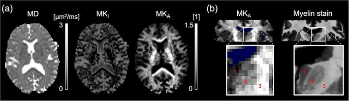 https://cdn.ncbi.nlm.nih.gov/pmc/blobs/6efa/6865792/33de589b9a40/HBM-40-2529-g002.jpg