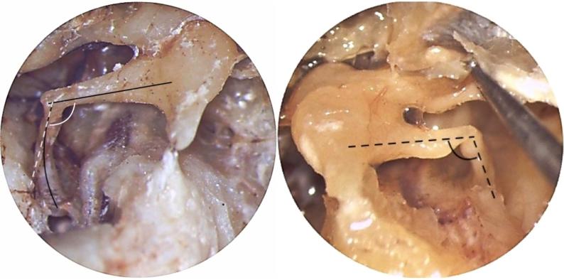 https://cdn.ncbi.nlm.nih.gov/pmc/blobs/6efe/7231975/273c0db1d6ce/gr2.jpg