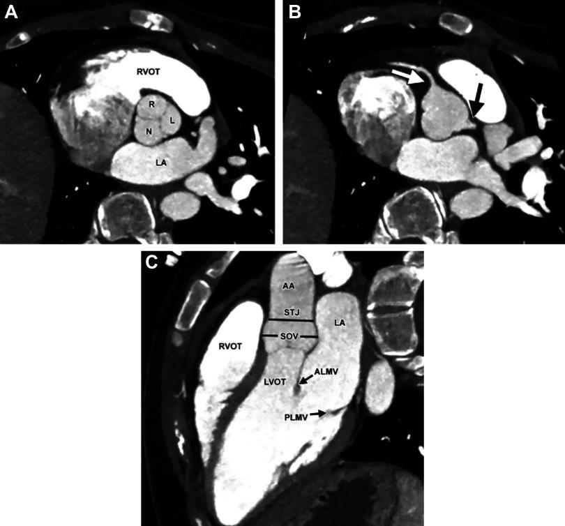https://cdn.ncbi.nlm.nih.gov/pmc/blobs/6f00/11495199/0b285eabef53/physrev.00038.2022_f025.jpg