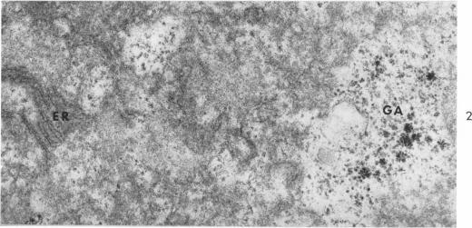 https://cdn.ncbi.nlm.nih.gov/pmc/blobs/6f06/1920415/2576bdce52b7/amjpathol00294-0103-b.jpg