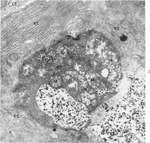 https://cdn.ncbi.nlm.nih.gov/pmc/blobs/6f06/1920415/5fc2138a5ce4/amjpathol00294-0105-a.jpg