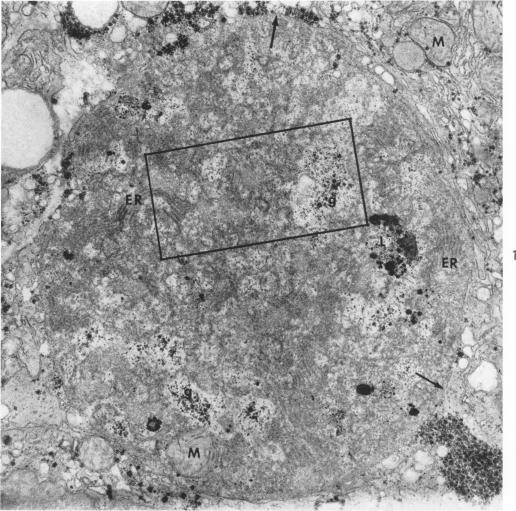 https://cdn.ncbi.nlm.nih.gov/pmc/blobs/6f06/1920415/81966967e48c/amjpathol00294-0103-a.jpg