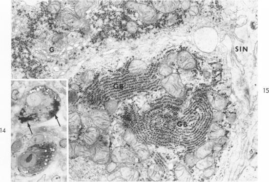 https://cdn.ncbi.nlm.nih.gov/pmc/blobs/6f06/1920415/e710eeecea60/amjpathol00294-0113-a.jpg