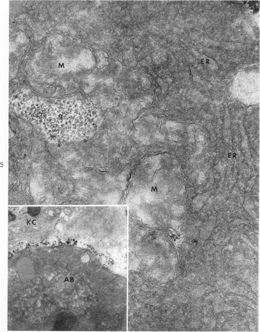 https://cdn.ncbi.nlm.nih.gov/pmc/blobs/6f06/1920415/f2bdfb27603c/amjpathol00294-0106-a.jpg