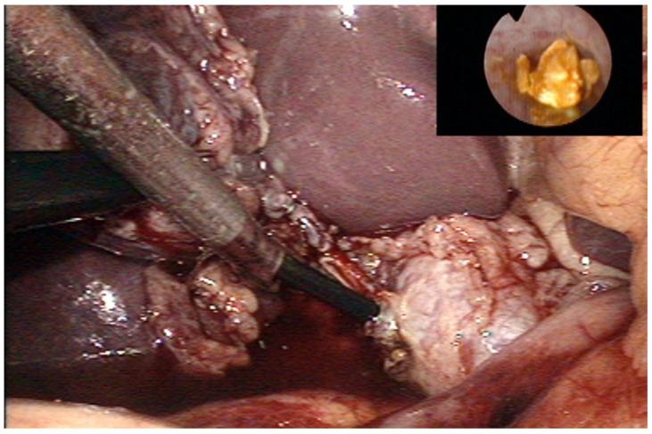 https://cdn.ncbi.nlm.nih.gov/pmc/blobs/6f0d/9601212/47c16e76e7c2/children-09-01583-g002.jpg