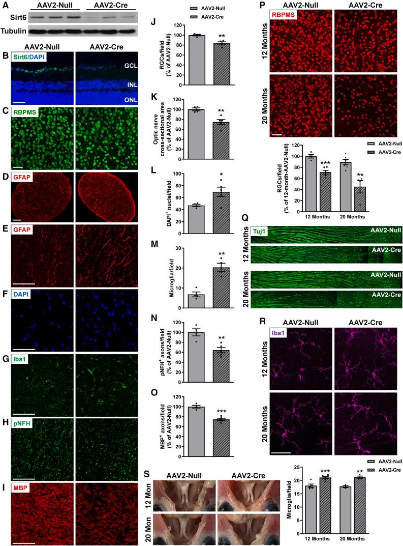 https://cdn.ncbi.nlm.nih.gov/pmc/blobs/6f13/11184404/dd5c88e57b27/gr2.jpg