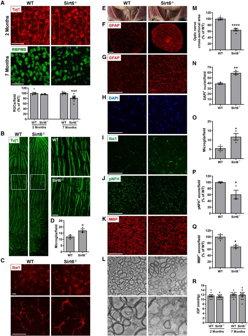 https://cdn.ncbi.nlm.nih.gov/pmc/blobs/6f13/11184404/e1182afcf574/gr1.jpg