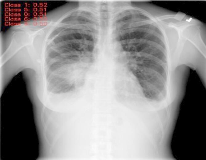 https://cdn.ncbi.nlm.nih.gov/pmc/blobs/6f13/12399747/d1735d4841d1/41598_2025_16669_Fig8_HTML.jpg