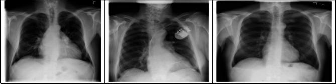 https://cdn.ncbi.nlm.nih.gov/pmc/blobs/6f13/12399747/ffa1df3bcc5e/41598_2025_16669_Fig6_HTML.jpg