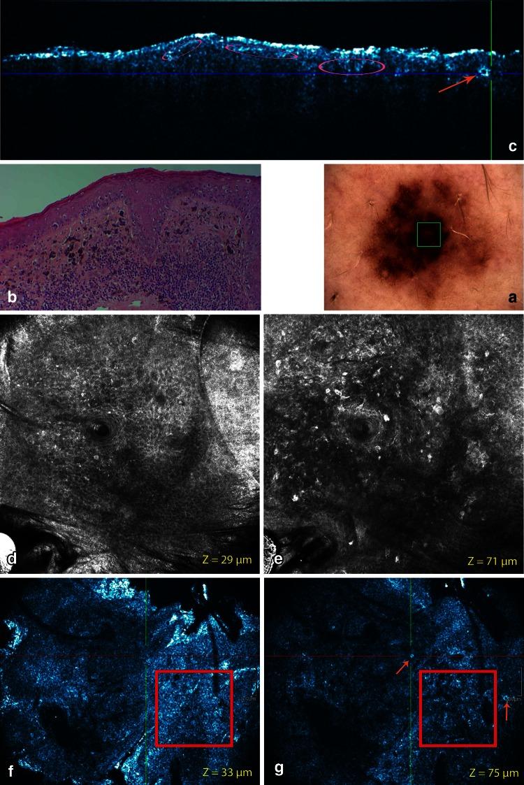 https://cdn.ncbi.nlm.nih.gov/pmc/blobs/6f1b/3889675/54f6fdd7af68/403_2013_1387_Fig8_HTML.jpg
