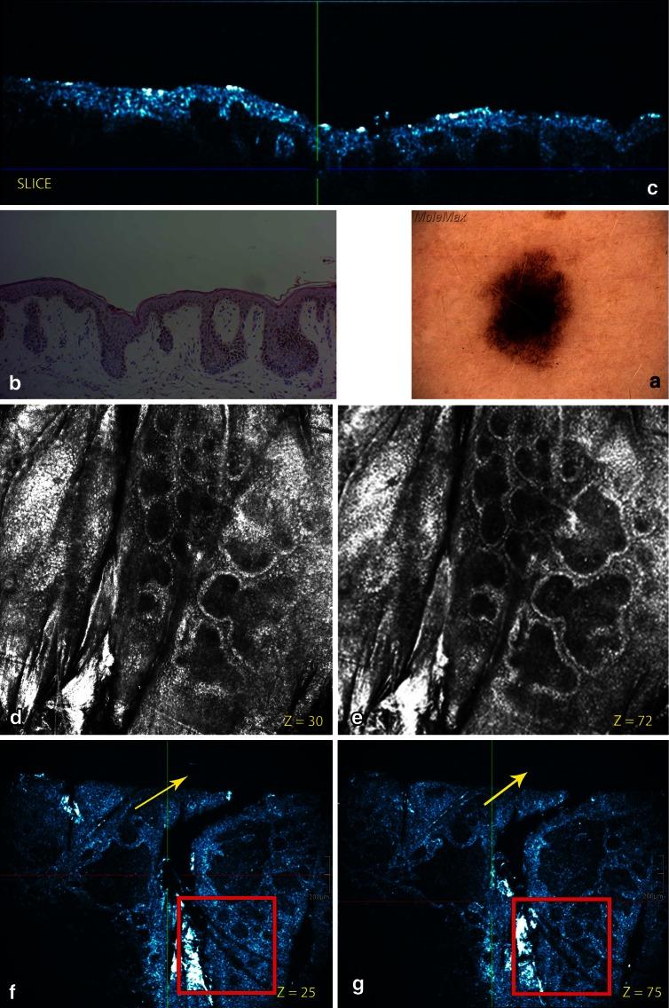 https://cdn.ncbi.nlm.nih.gov/pmc/blobs/6f1b/3889675/831e302d1e39/403_2013_1387_Fig1_HTML.jpg