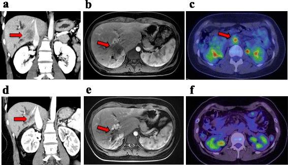 https://cdn.ncbi.nlm.nih.gov/pmc/blobs/6f21/5698235/9e68d380f352/40792_2017_395_Fig1_HTML.jpg