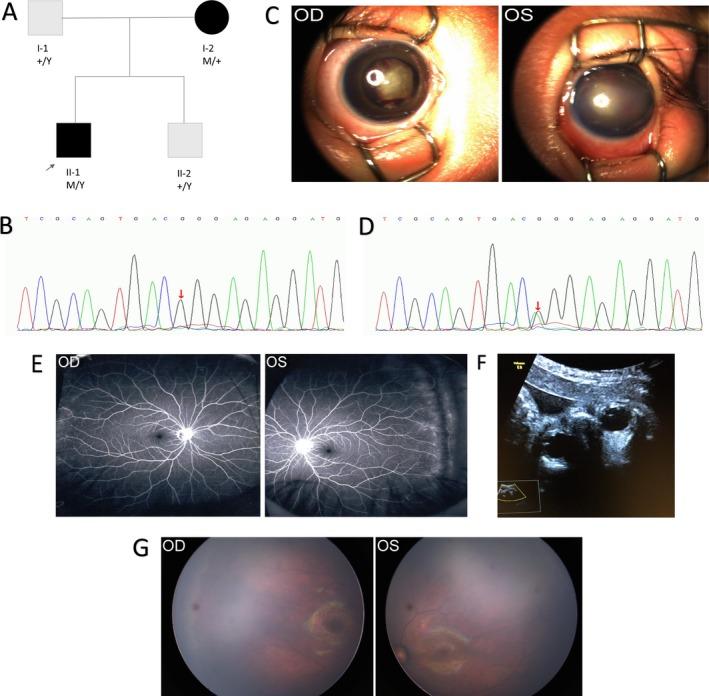 https://cdn.ncbi.nlm.nih.gov/pmc/blobs/6f21/6382493/5f5247ecdaed/MGG3-7-na-g001.jpg