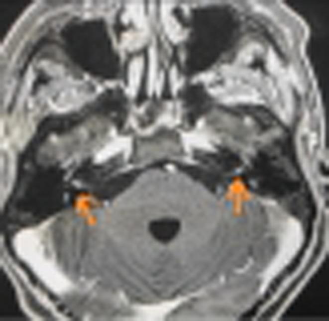 https://cdn.ncbi.nlm.nih.gov/pmc/blobs/6f39/9552548/cb39178c4b63/CCR3-10-e6412-g002.jpg