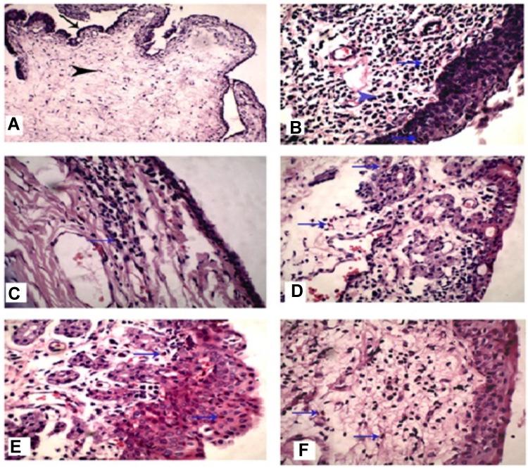 https://cdn.ncbi.nlm.nih.gov/pmc/blobs/6f50/8627895/2845e0e1f462/IJN-16-7775-g0009.jpg