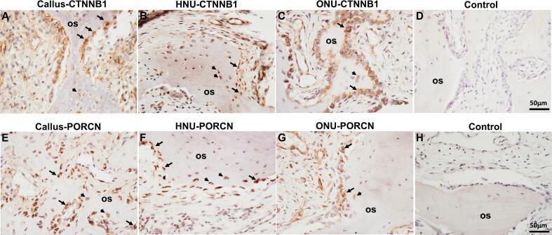 https://cdn.ncbi.nlm.nih.gov/pmc/blobs/6f51/11245924/ade8656b77e7/gr6.jpg