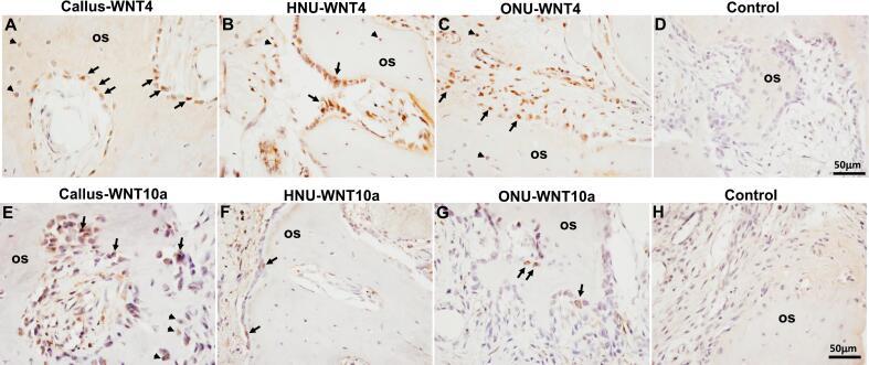 https://cdn.ncbi.nlm.nih.gov/pmc/blobs/6f51/11245924/db182b84d539/gr3.jpg