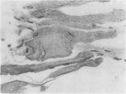 https://cdn.ncbi.nlm.nih.gov/pmc/blobs/6f53/1000222/903395e7ae3f/annrheumd00085-0076-a.jpg